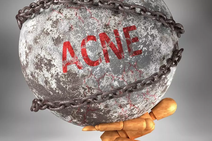 Acné sévère-sosacne.fr